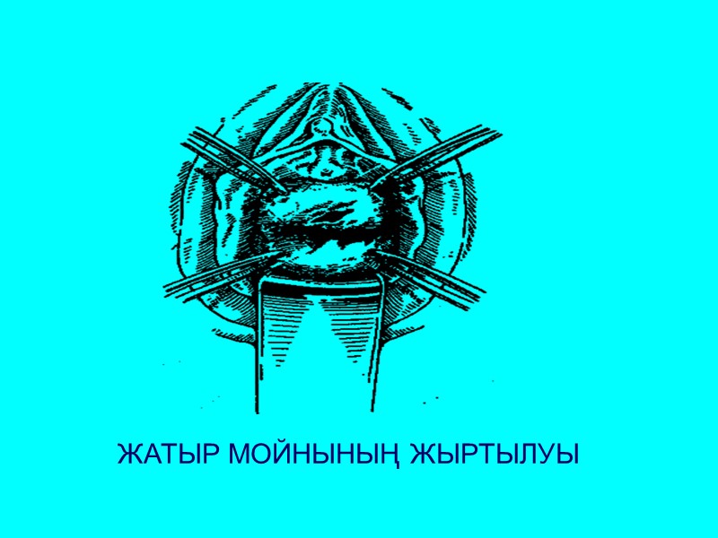 ЖАТЫР МОЙНЫНЫҢ ЖЫРТЫЛУЫ